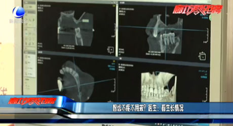 智齒不疼不用拔？醫(yī)生：看生長(zhǎng)情況