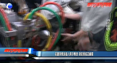 機器人手臂誤插入男子臀部 消防員成功解救
