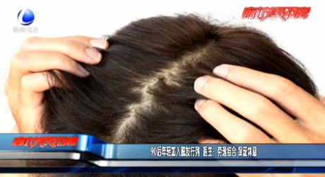 90后加入脫發(fā)行列 醫(yī)生：勞逸結(jié)合 保證休息