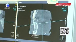 牙齒缺失怎么辦 口腔專家表示：應(yīng)及時(shí)修復(fù)