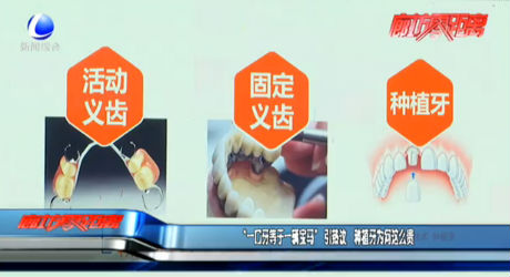 “一口牙等于一輛寶馬”引熱議 種植牙為何這么貴