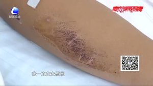 零距離·交通：醉駕男子強行闖卡  拖行交警數(shù)十米