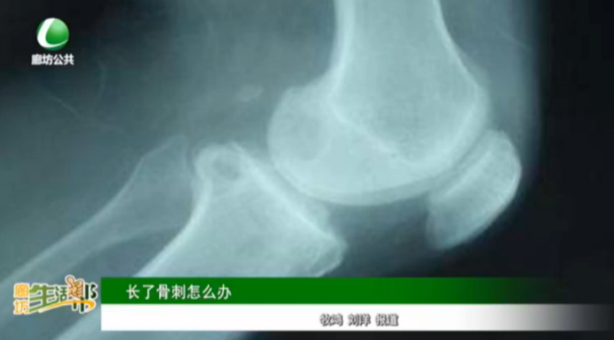 長了骨刺怎么辦